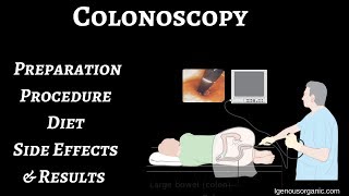 Colonoscopy preparation procedure diet Side effects and results [upl. by Burr]