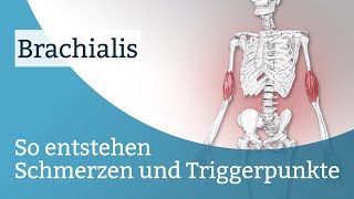 Brachialis Schmerzen Triggerpunkte und deren Aktivierung [upl. by Thomey]