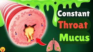 6 Real Causes of Phlegm amp Mucus in Your Throat Stop Constant Throat Clearing  VisitJoy [upl. by Seniag949]