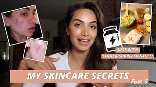 HOW I HEALED MY SKIN WITH FOOD AND SUPPLEMENTS  MY SKINCARE JOURNEY PART 3 [upl. by Caty]