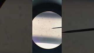 Heartworm under microscope Dirofilaria immitis Veterinary Video [upl. by Jarlen]