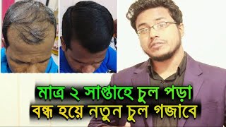 এই বায়াম টি করে ৭০ শতাংশ লোক তাদের হারানো চুল ফিতে পেতে পারে। [upl. by Phelgon]