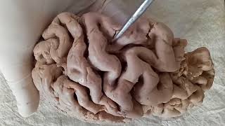 NEUROANATOMY  CEREBRAL CORTEX PART1 SULCI AND GYRI  BY DR MITESH DAVE [upl. by Gierk995]