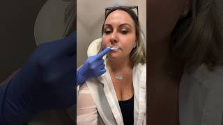 Getting my lips amp Botox done [upl. by Emanuele]