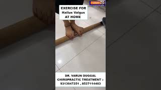 CHIROPRACTIC TREATMENT IN INDIA  EXERCISE FOR Hallux Valgus AT HOME  DR VARUN DUGGAL CHIROPRACTIC [upl. by Nauqahs]