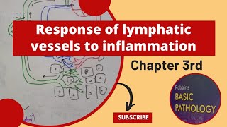 Responses of Lymphatic Vessels and Lymph Nodes to Inflammation LymphangitisLymphadenitisrobbins [upl. by Tenenbaum]