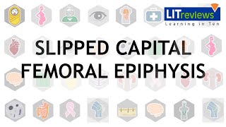 Slipped Capital Femoral Epiphysis [upl. by Mandi]