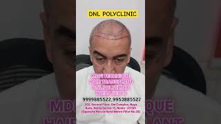 polyclinic haircare transformation hair noida treatment [upl. by Gualterio660]