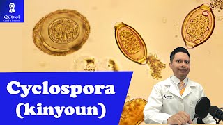 Conoce a Cyclospora cayetanensis con tinción de KINYOUN [upl. by Nair]