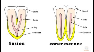 Developmental disturbances in shape of teeth  Part 1 [upl. by Anora]