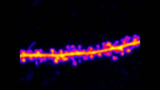 dendritic spines and filopodia [upl. by Rovaert171]