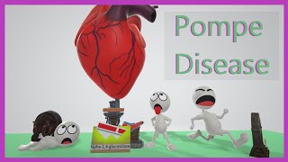 Pompe Disease Mnemonic for the USMLE [upl. by Nicram749]