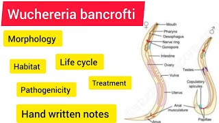 wuchereria bancrofti Zoology BSC 3rd year handwritennotes hpu viralvideo likeandsubscribe [upl. by Fornof991]