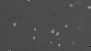 The pseudopodial movement of N gruberi [upl. by Schurman]