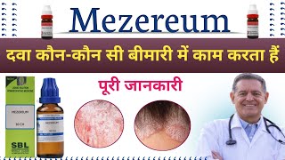 Mezereum 30  Mezereum 200  Mezereum Homoeopathic Medicine Uses In Hindi [upl. by Llien]