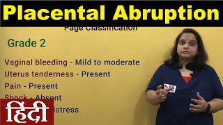 Antepartum Hemorrhage in Hindi  Placental Abruption Clinical Types Grading Signs  Nursing Lecture [upl. by Sofia]