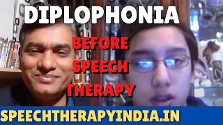 SLP Sanjay Kumar Pre Diplophonia Therapy  Soft Voice  Pitch Break Correction [upl. by Enohsal578]