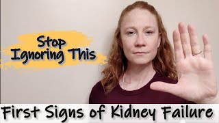 Kidney Disease Whos at risk 6 Early Signs and the Tests you need [upl. by Nuavahs718]