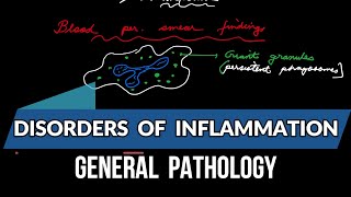 Disorders of Inflammation General pathology [upl. by Sudnak]