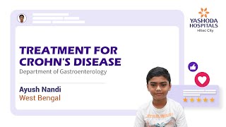 Treatment for Crohns Disease  Yashoda Hospitals Hyderabad [upl. by Gustave]