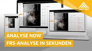 Analyse Now  FRSAnalyse in wenigen Sekunden [upl. by Hajidak886]