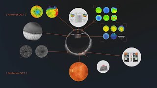 Optovue SOLIX by Visionix  Das Ultrahighspeed FullRange OCT von den Erfindern der OCTAngiographie [upl. by Arikat]