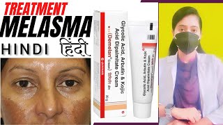 Melasma treatment HINDI Demelan cream reviewDr Malanbi [upl. by Hanus]