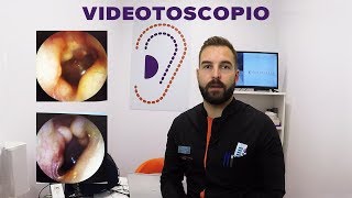 Otoscopia con videotoscopio revisión de oído mediante vídeo [upl. by So]