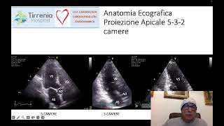 Corso Ecografia Anatomia Ecografia Cardiovascolare 1° Parte [upl. by Orips]