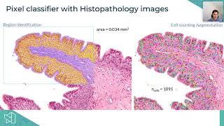 Aurox Conference on Microscopy 2020  Day 2 Session 1  Image Analysis and AI NEW [upl. by Aivizt]