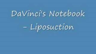 DaVincis Notebook  Liposuction [upl. by Lucina]