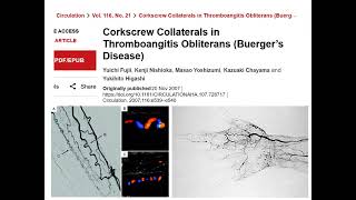 Buergers Disease [upl. by Neeroc]