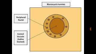 Stool Analysis 14 Blastocystis hominis [upl. by Zurn161]