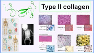 type II collagen [upl. by Janaya]