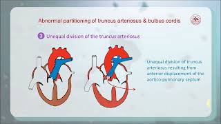 8 4 Partitioning of truncus arteriosus and bulbus cordis 齐鲁医学院 [upl. by Cleres]