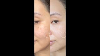 My night time skin care routine using Faded topicals Brightening and Clearing Serum [upl. by Avron]