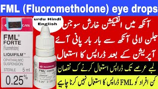 FML eye drops uses  fluorometholone eye drops  corticosteroids eye drops  eye infection treatment [upl. by Einohtna]