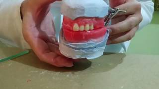 Enfilado de dientes artificiales en prótesis total 12 [upl. by Griz]