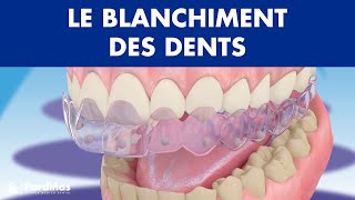 Blanchiment dentaire © [upl. by Gusba]