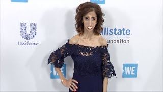 Lizzie Velasquez 2017 quotWE Dayquot California Event [upl. by Dearborn154]