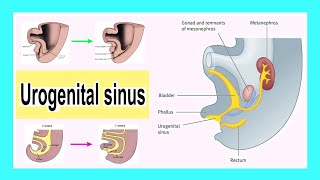 urogenital sinus [upl. by Behre]