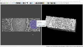 Trabecular Bone Analysis  Imalytics Preclinical Application Demo [upl. by Nalo]