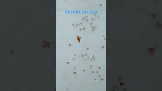 Jellyfish life cycle strobilation jellyfish sealife jellyfishfacts shortvideo short [upl. by Letsyrc272]