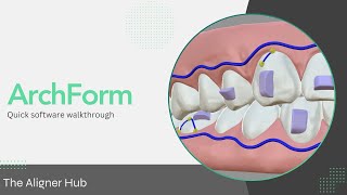 Archform Software Walkthrough [upl. by Aisek]