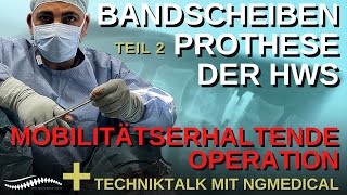 BandscheibenoperationProthese der HWS bandscheibenvorfallbandscheibenersatzngmedical [upl. by Essam]