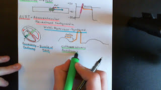 Cardiac Arrhythmias Part 7 [upl. by Ail544]