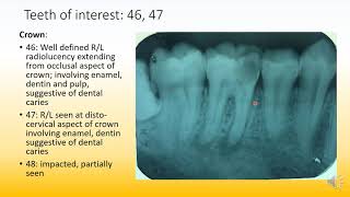 Radiographic interpretation made easy case 9 Solved examples [upl. by Reivaz]