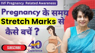 How to Prevent Stretch Marks During Pregnancy  Expert Tips by Dr Malti Bhojwani [upl. by Belak]