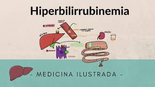 Metabolismo Bilirubina  Alteraciones [upl. by Akemak]