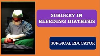 SURGERY IN BLEEDING DIATHESIS [upl. by Plath]